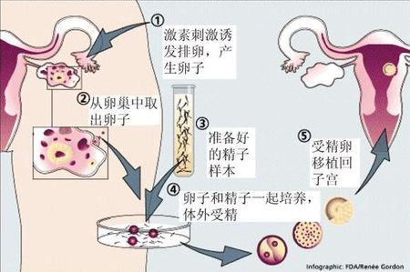 元准生殖医学中心